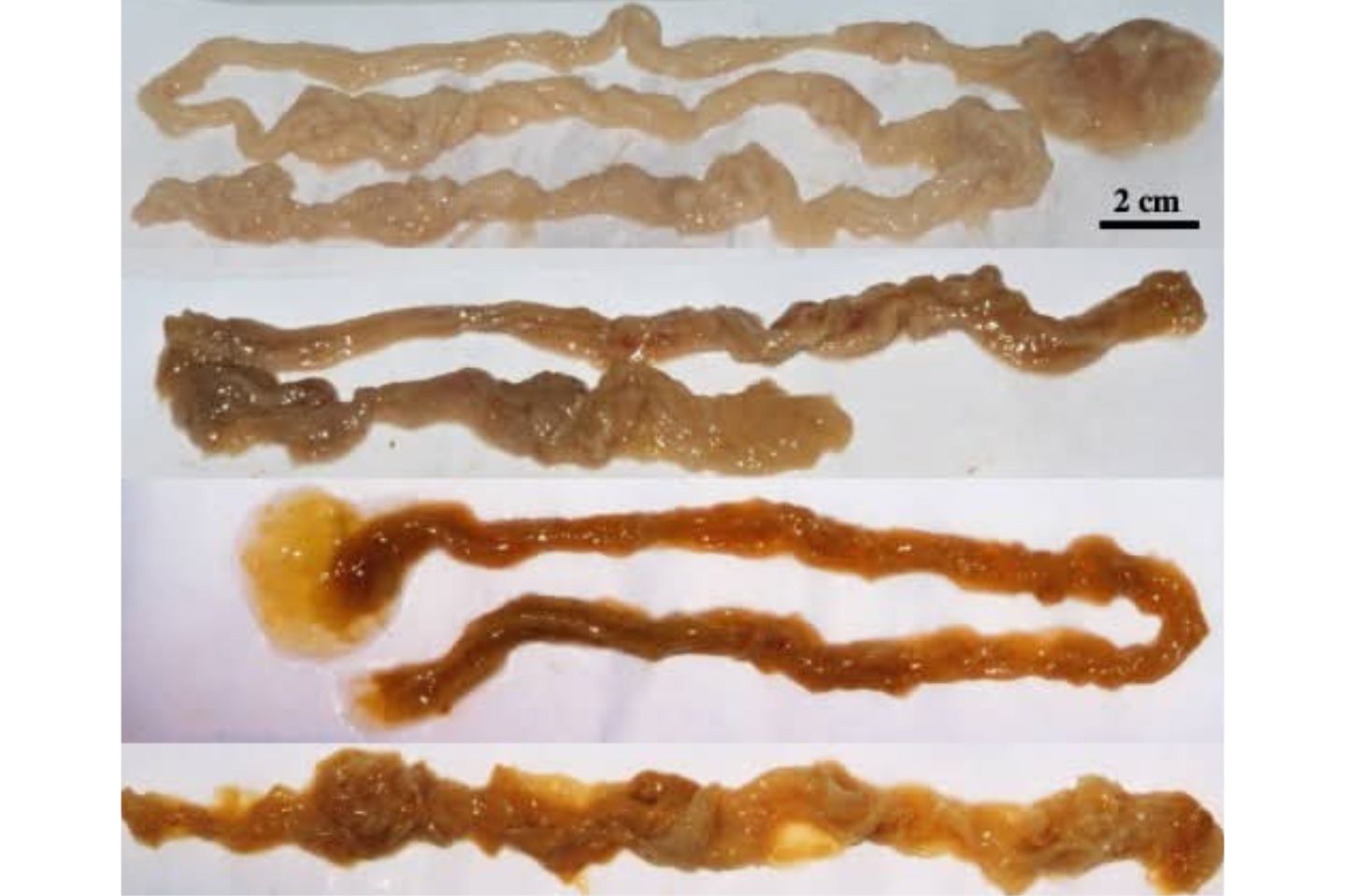 Protokół Oczyszczania Organizmu