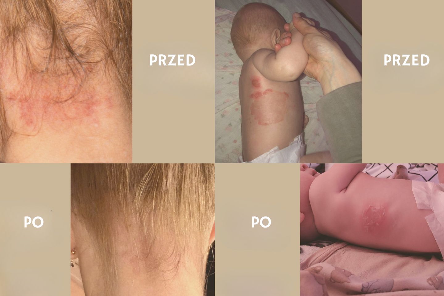 Protokół Oczyszczania Organizmu